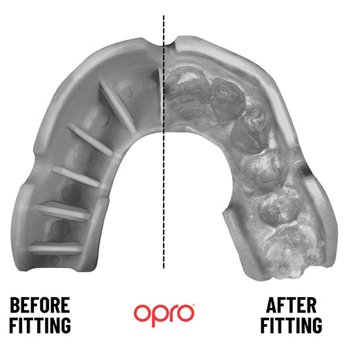 
                  
                    OPRP Silver Self-Fit Mouthguards are supplied by Ourschoolwear Wrexham
                  
                